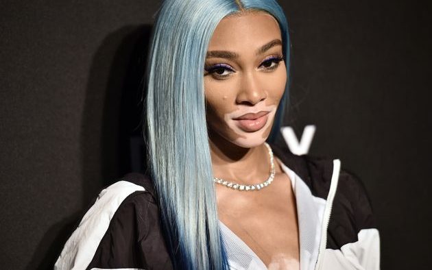 Model Winnie Harlow Faces Backlash After Complaining About Flying In Coach